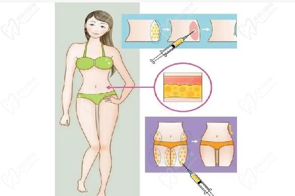 哈爾濱羽禪醫(yī)美楊宇梓口碑評(píng)價(jià)與就診指南