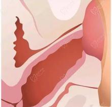 上海九龍醫(yī)院潘麗琴怎么樣-做MEC生物束帶微創(chuàng)陰道緊縮修復(fù)盆底肌改善漏尿好評(píng)高